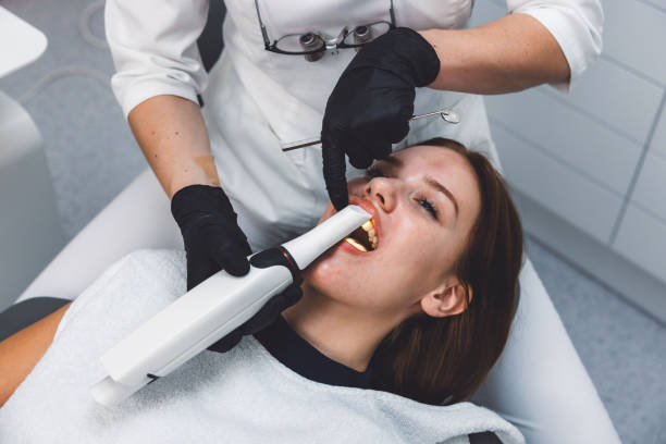 Best Emergency Wisdom Teeth Removal in Fremont, CA